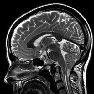 brain